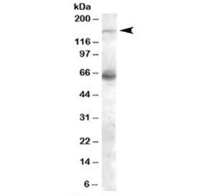 Western blot testing of human skeletal muscle lysate with NOS1 antibody at 0.1ug/ml. Predicted/obser