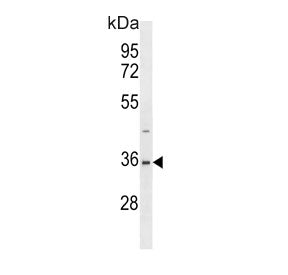 Western blot testing of human HEK293 cell lysate with SUMO-activating enzyme subunit 1 antibody. Pre