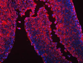 CES2 Antibody / Carboxylesterase 2