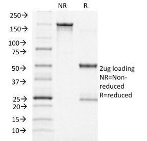 CLIP Antibody / ACTH