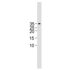 Western blot testing of human placental tissue lysate with Choriogonadotropin beta antibody. Predicted molecular weight ~18 kDa (Choriogonadotropin beta subunit) and ~40 kDa (Choriogonadotropin).