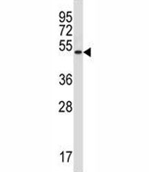Rage antibody western blot analysis in NCI-H292 lysate. Predicted molecular weight: 45-55kDa dependi