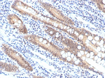 SMAD4 Antibody