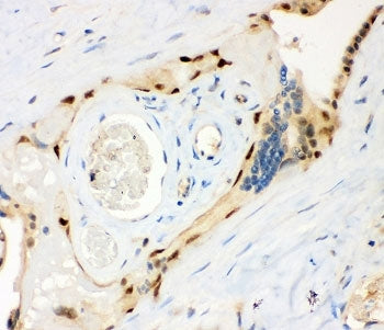 IHC staining of FFPE human placental tissue with MSK1 antibody. HIER: boil tissue sections in pH8 ED