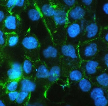 Immunofluorescent testing of FFPE human A431 cells with Beta Catenin antibody. HIER: boil tissue sec