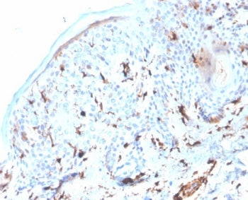 IHC staining of FFPE human skin tissue with S100A4 antibody (clone S100A4/6995). HIER: boil tissue s