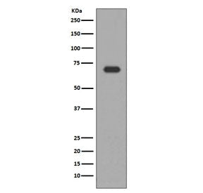 Western blot testing of human HepG2 cell lysate with ALAS1 antibody. Predicted molecular weight ~71 