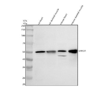Western blot analysis of SMYD1 using anti-SMYD1 antibody. Electrophoresis was performed on a 10% SDS