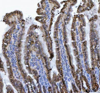 CDH17 Antibody / Cadherin 17