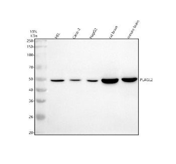 Western blot analysis of PLAGL2 using anti-PLAGL2 antibody. Electrophoresis was performed on a 10% S
