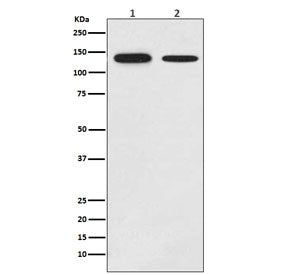 Western blot testing of 1) human MCF-7 and 2) mouse brain lysate with GHR antibody. Predicted molecu
