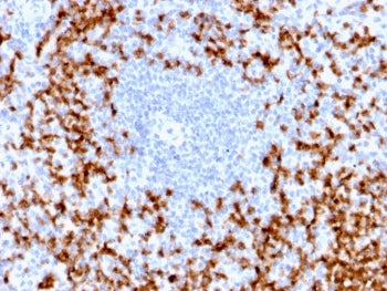 IHC testing of FFPE human spleen with recombinant MMP9 antibody (clone MMP9/2025R). Required HIER: b