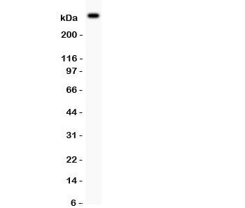 von Willebrand Factor Antibody