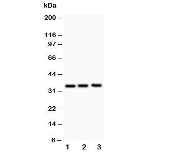 Western blot testing of GM-CSF antibody and Lane 1: Jurkat; 2: HeLa; 3: HT1080; The protein is visua