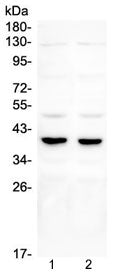 DMRT1 Antibody
