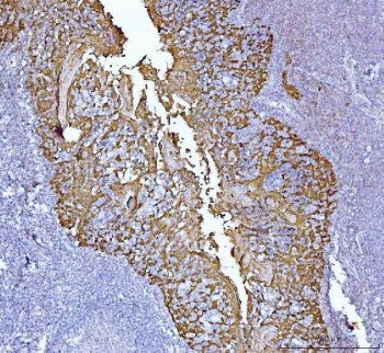 IHC staining of FFPE human tonsil tissue with MASPIN antibody. HIER: boil tissue sections in pH8 EDT