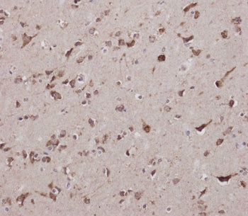 IHC testing of FFPE human brain tissue with CBS antibody. HIER: steam section in pH9 EDTA for 20 min