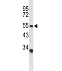 ACCN2 Antibody / ASIC1