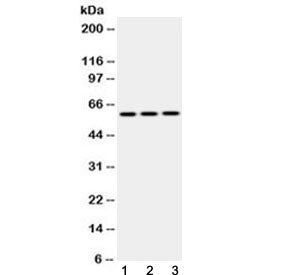 Cytokeratin 14 Antibody (CK14, KRT14)