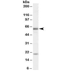 Western blot testing of HeLa cell lysate with BMPR1A antibody at 1ug/ml. Molecular weight: he expect