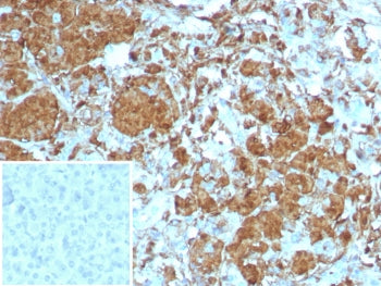 IHC staining of FFPE human pancreas tissue with Carboxypeptidase A1 antibody (clone CPA1/8258R). Ins