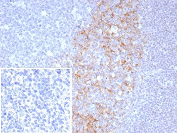 CD23 Antibody
