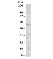 Western blot testing of human heart lysate with OSBPL2 antibody at 1.5ug/ml. Predicted molecular wei