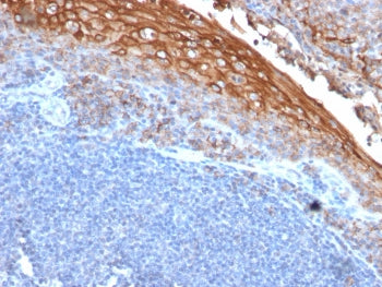 IHC testing of FFPE human tonsil with CD146 antibody (clone rMUC18/1130). Required boiling tissue se