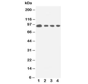 Western blot testing of human 1: HeLa; 2: COLO320; 3: Jurkat; 4: CEM cell lysate with STAT5a antibod
