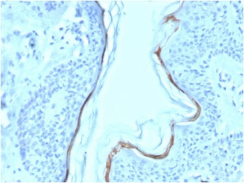 IHC testing of FFPE human skin with biotinylated Filaggrin antibody (clone FLG/1563). Required HIER: