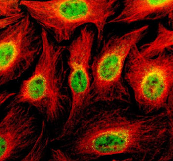Immunofluorescent staining of TBKBP1 using anti-TBKBP1 antibody (green) and anti-Beta Tubulin antibo