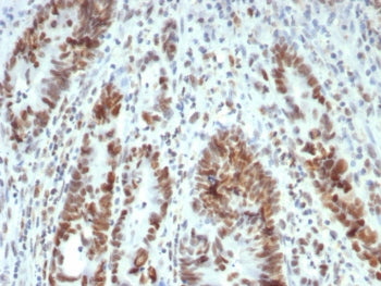 IHC staining of FFPE human colon tissue with MutL Homolog 1 antibody (clone MLH1/7563). HIER: boil t