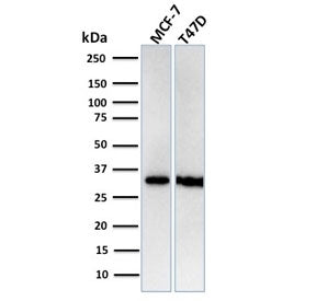 Western blot testing of human MCF7 and T47D cell lysate with recombinant RPA32 antibody. Expected mo