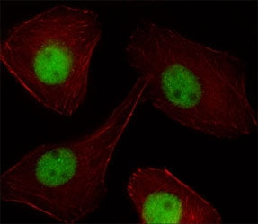 Fluorescent image of U251 cell stained with PR antibody at 1:25. Immunoreactivity is localized to th