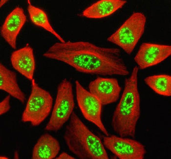 Immunofluorescent staining of SON using anti-SON antibody (green) and anti-Beta Tubulin antibody (re