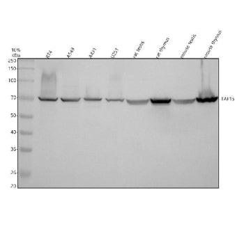 Western blot analysis of TAF15 using anti-TAF15 antibody. Electrophoresis was performed on a 10% SDS