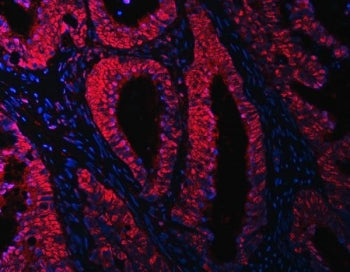 OTT3 Antibody / RBM15B