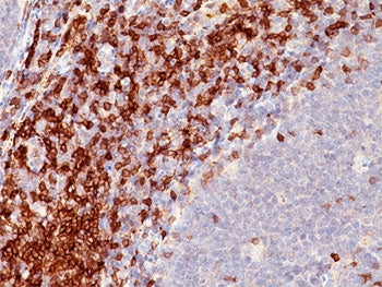 CD5 Antibody