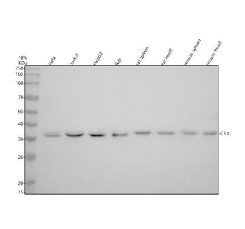 Western blot analysis of CRKL using anti-CRKL antibody. Electrophoresis was performed on a 10% SDS-P