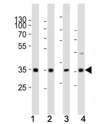Cyclin D3 Antibody (CCND3)