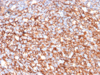 IHC staining of FFPE human tonsil tissue with CD73 antibody (clone NT5E/2646). HIER: boil tissue sec