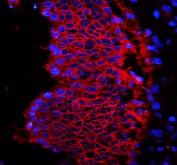 EpCAM Antibody