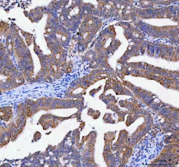 LYPLA1 Antibody / Lysophospholipase 1 / LPL-I