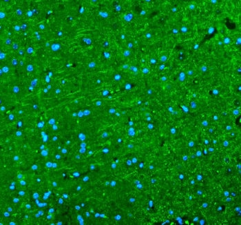 Alpha Internexin Antibody / Neurofilament-66