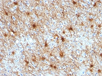 GFAP Antibody / Glial Fibrillary Acidic Protein