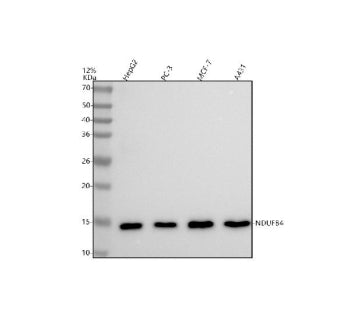 Western blot analysis of NDUFB4 using anti-NDUFB4 antibody. Lane 1: human HepG2 whole cell lysates, 