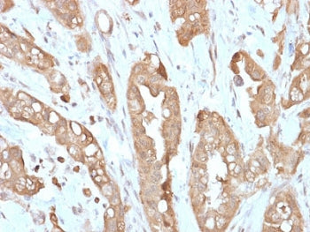IHC testing of FFPE human small intestine with recombinant Villin antibody (clone VIL1/2310R). Requi