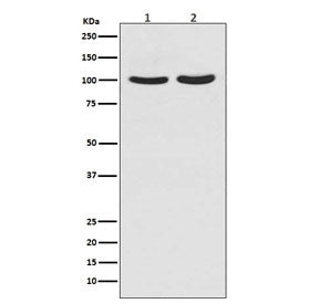 Western blot testing of human 1) T-47D and 2) LNCaP cell lysate with Androgen Receptor antibody. Pre