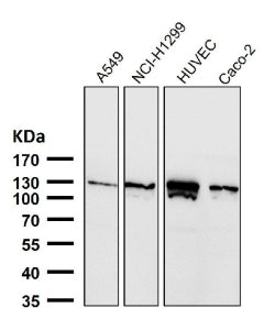 Western blot testing of human samples using the PALLD antibody at 1:3000 dilution for 1 hour at room