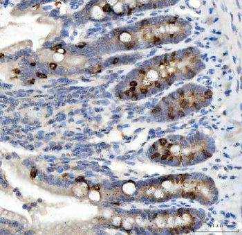 IHC staining of FFPE rat colon tissue with NOX1 antibody. HIER: boil tissue sections in pH8 EDTA for